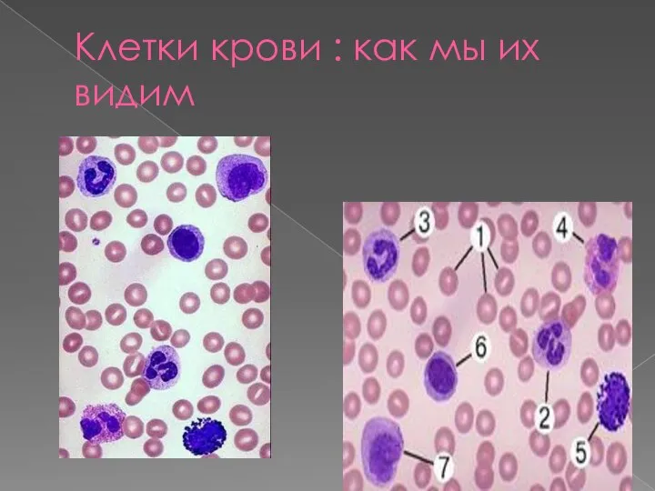 Клетки крови : как мы их видим