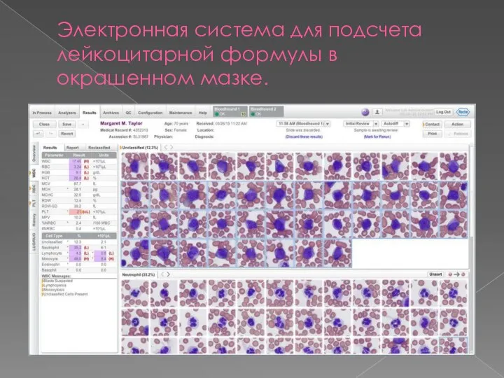 Электронная система для подсчета лейкоцитарной формулы в окрашенном мазке.