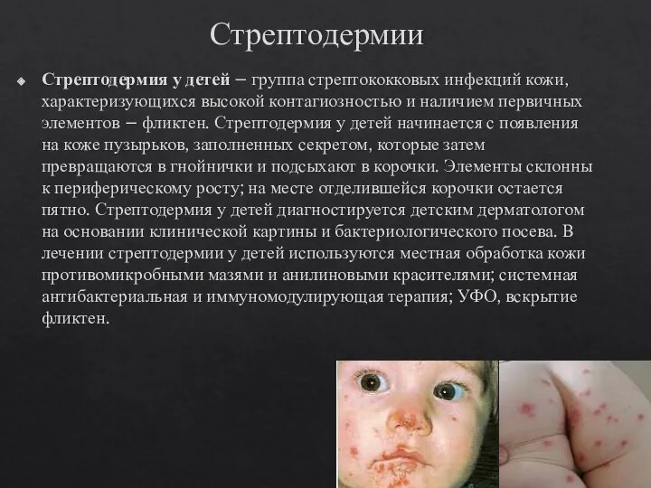 Стрептодермии Стрептодермия у детей – группа стрептококковых инфекций кожи, характеризующихся высокой