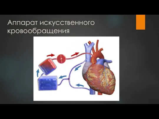 Аппарат искусственного кровообращения