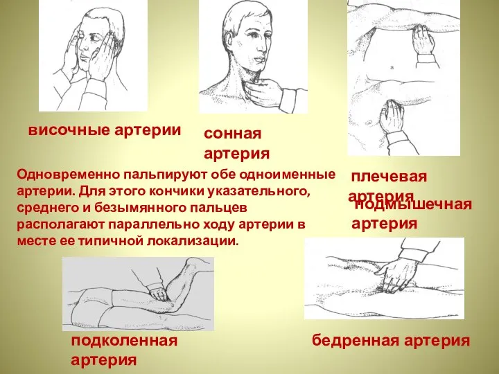 височные артерии сонная артерия плечевая артерия подмышечная артерия бедренная артерия подколенная