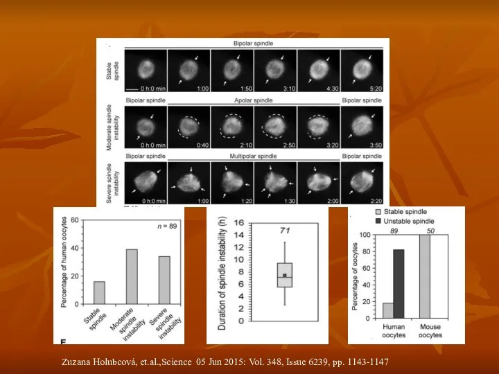 Zuzana Holubcová, et.al.,Science 05 Jun 2015: Vol. 348, Issue 6239, pp. 1143-1147