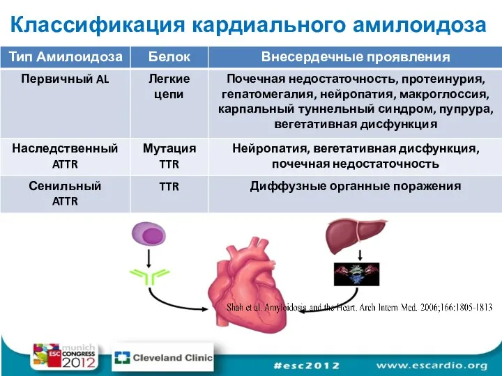Классификация кардиального амилоидоза