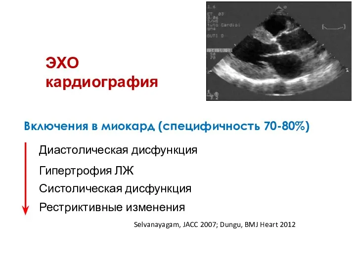 Включения в миокард (специфичность 70-80%) Диастолическая дисфункция Гипертрофия ЛЖ Систолическая дисфункция