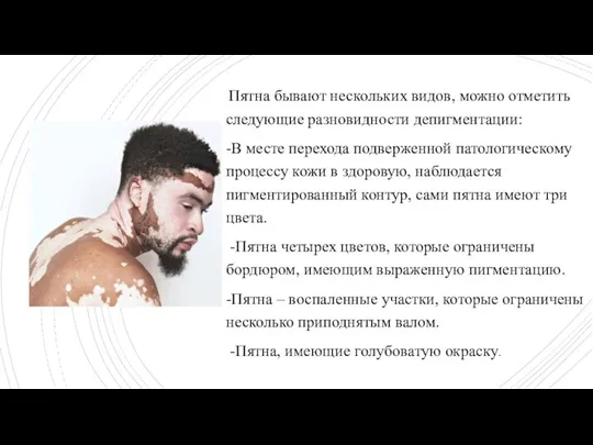 Пятна бывают нескольких видов, можно отметить следующие разновидности депигментации: -В месте