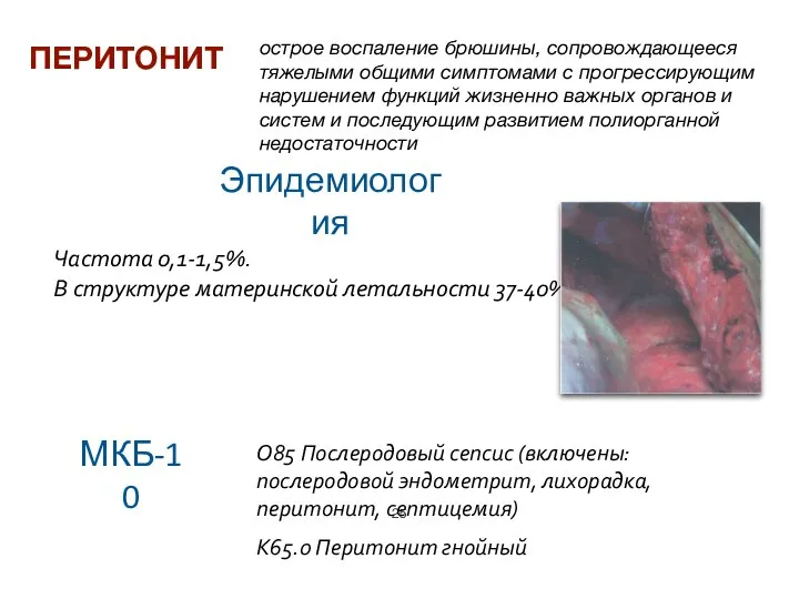 Частота 0,1-1,5%. В структуре материнской летальности 37-40% ПЕРИТОНИТ острое воспаление брюшины,