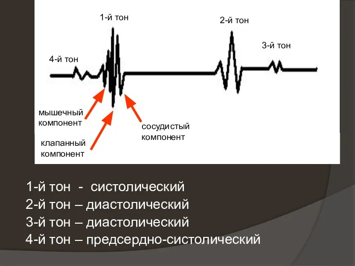 1-й тон - систолический 2-й тон – диастолический 3-й тон – диастолический 4-й тон – предсердно-систолический