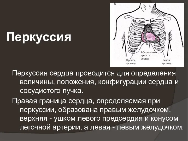 Перкуссия Перкуссия сердца проводится для определения величины, положения, конфигурации сердца и