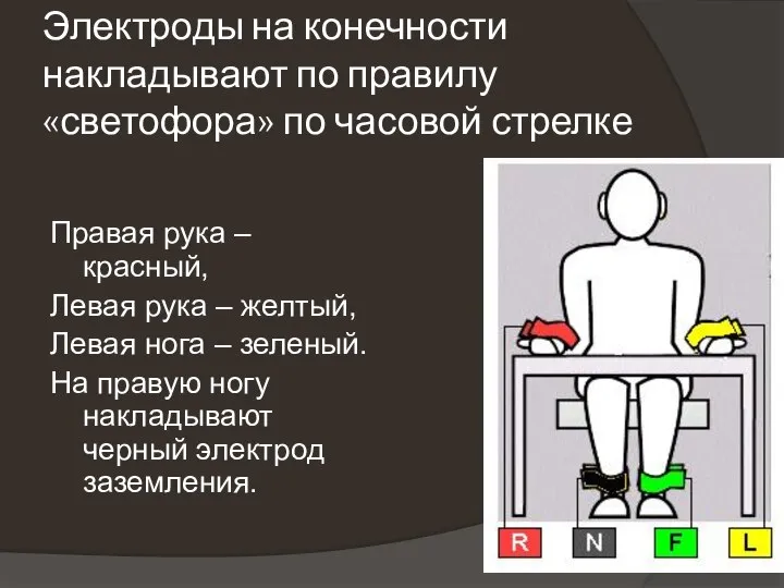 Электроды на конечности накладывают по правилу «светофора» по часовой стрелке Правая