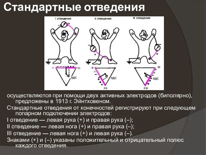 Стандартные отведения осуществляются при помощи двух активных электродов (биполярно), предложены в