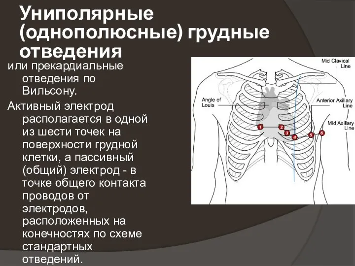 Униполярные (однополюсные) грудные отведения или прекардиальные отведения по Вильсону. Активный электрод