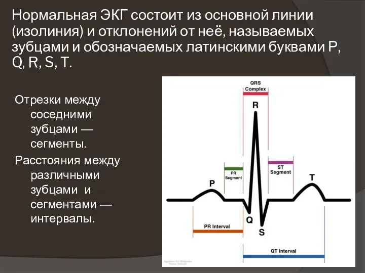 Нормальная ЭКГ состоит из основной линии (изолиния) и отклонений от неё,