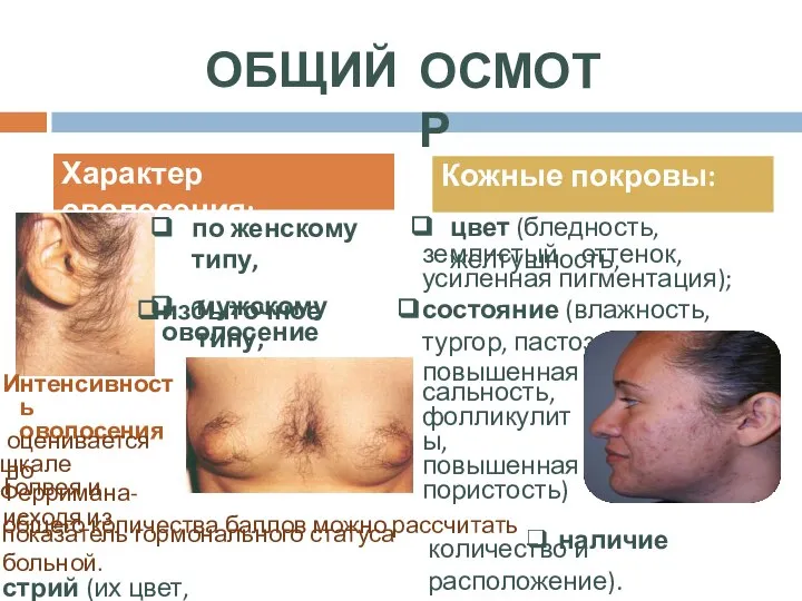 ОБЩИЙ ОСМОТР цвет (бледность, желтушность, землистый оттенок, усиленная пигментация); состояние (влажность,