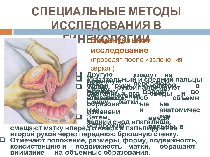 СПЕЦИАЛЬНЫЕ МЕТОДЫ ИССЛЕДОВАНИЯ В ГИНЕКОЛОГИИ Бимануальное исследование (проводят после извлечения зеркал)