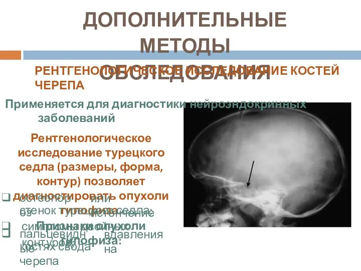 ДОПОЛНИТЕЛЬНЫЕ МЕТОДЫ ОБСЛЕДОВАНИЯ РЕНТГЕНОЛОГИЧЕСКОЕ ИССЛЕДОВАНИЕ КОСТЕЙ ЧЕРЕПА Применяется для диагностики нейроэндокринных