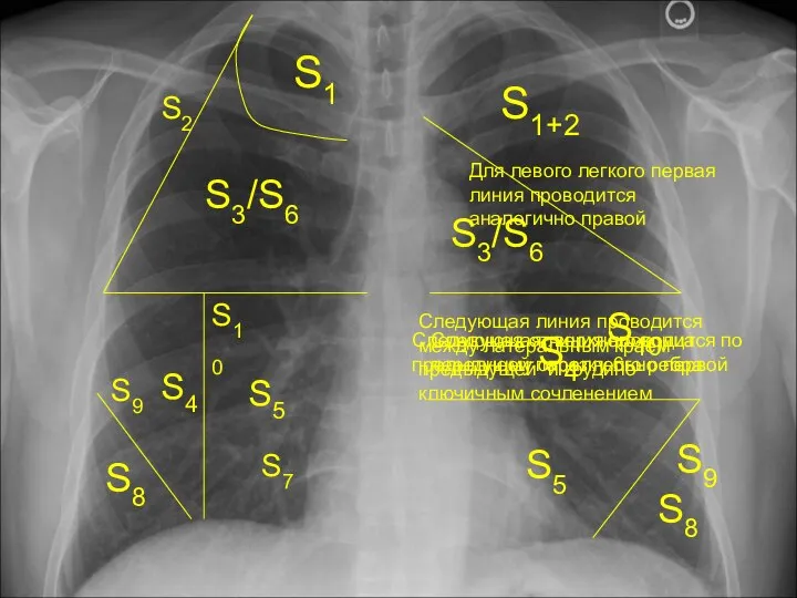 S1 S2 S3/S6 S8 S4 S5 S9 S10 S7 Для левого