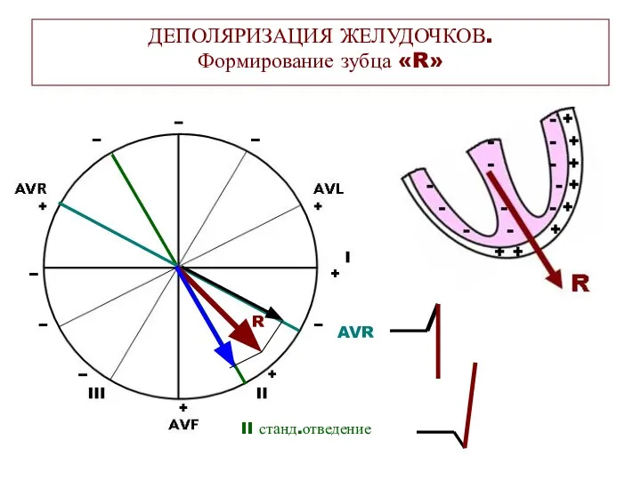 ДЕПОЛЯРИЗАЦИЯ ЖЕЛУДОЧКОВ. Формирование зубца «R» AVR II станд.отведение R