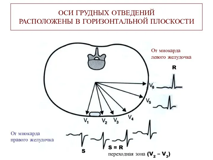 ОСИ ГРУДНЫХ ОТВЕДЕНИЙ РАСПОЛОЖЕНЫ В ГОРИЗОНТАЛЬНОЙ ПЛОСКОСТИ S R S =