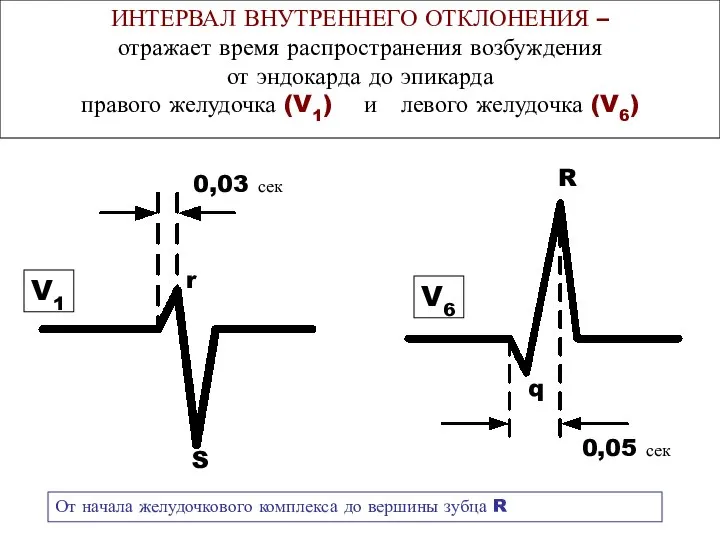 ИНТЕРВАЛ ВНУТРЕННЕГО ОТКЛОНЕНИЯ – отражает время распространения возбуждения от эндокарда до