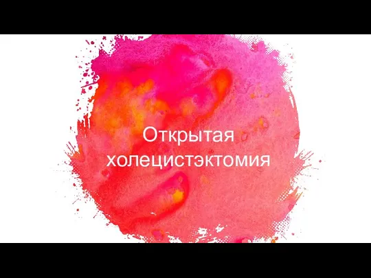 Открытая холецистэктомия