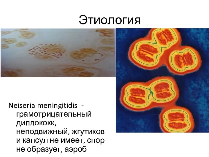 Этиология Neiseria meningitidis - грамотрицательный диплококк, неподвижный, жгутиков и капсул не имеет, спор не образует, аэроб