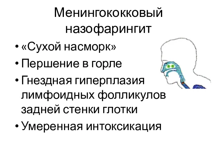 Менингококковый назофарингит «Сухой насморк» Першение в горле Гнездная гиперплазия лимфоидных фолликулов задней стенки глотки Умеренная интоксикация