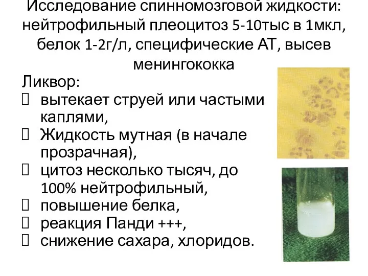 Исследование спинномозговой жидкости: нейтрофильный плеоцитоз 5-10тыс в 1мкл, белок 1-2г/л, специфические