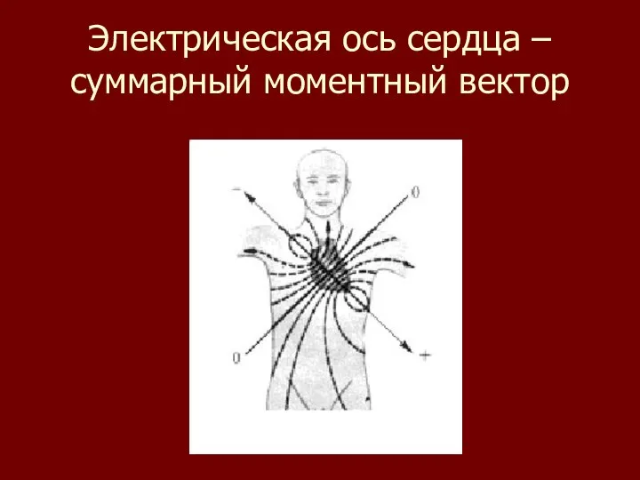 Электрическая ось сердца – суммарный моментный вектор