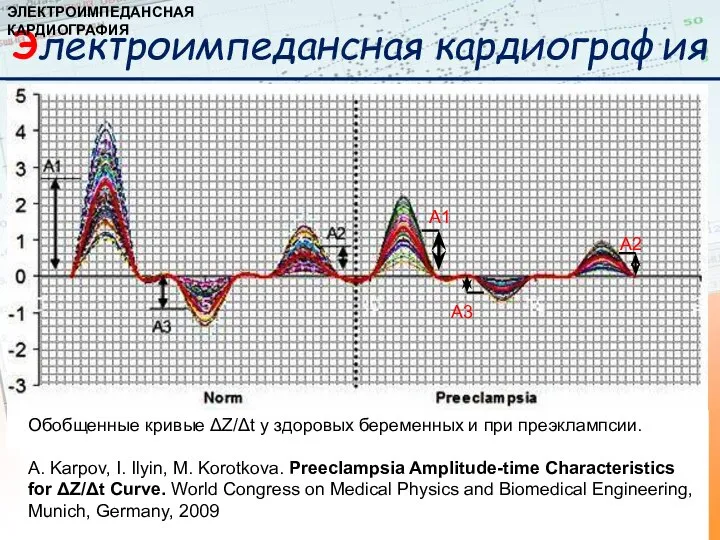 А1 А2 А3 Обобщенные кривые ΔZ/Δt у здоровых беременных и при