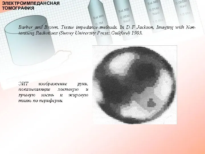 ЭЛЕКТРОИМПЕДАНСНАЯ ТОМОГРАФИЯ