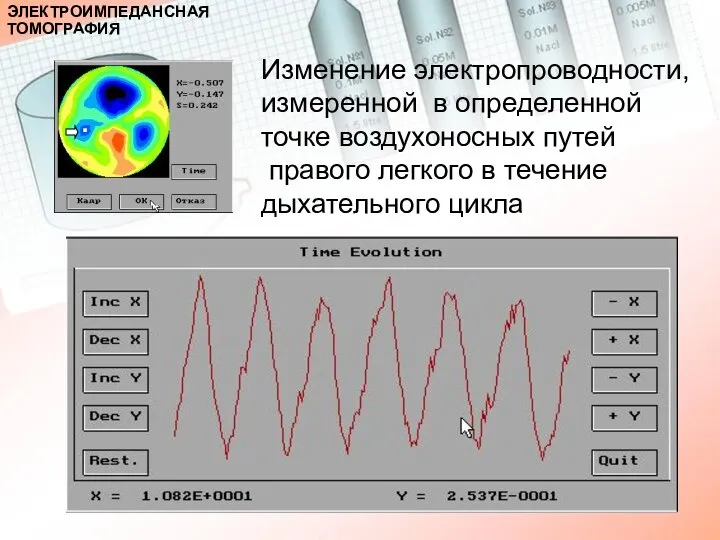 Изменение электропроводности, измеренной в определенной точке воздухоносных путей правого легкого в течение дыхательного цикла ЭЛЕКТРОИМПЕДАНСНАЯ ТОМОГРАФИЯ