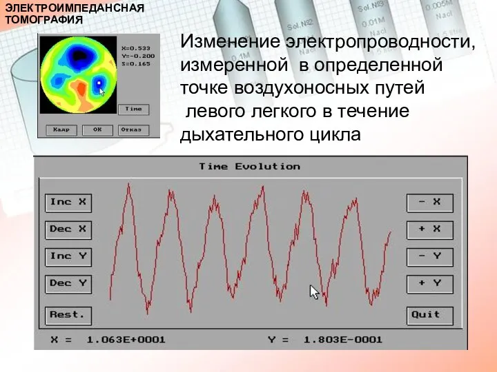 Изменение электропроводности, измеренной в определенной точке воздухоносных путей левого легкого в течение дыхательного цикла ЭЛЕКТРОИМПЕДАНСНАЯ ТОМОГРАФИЯ