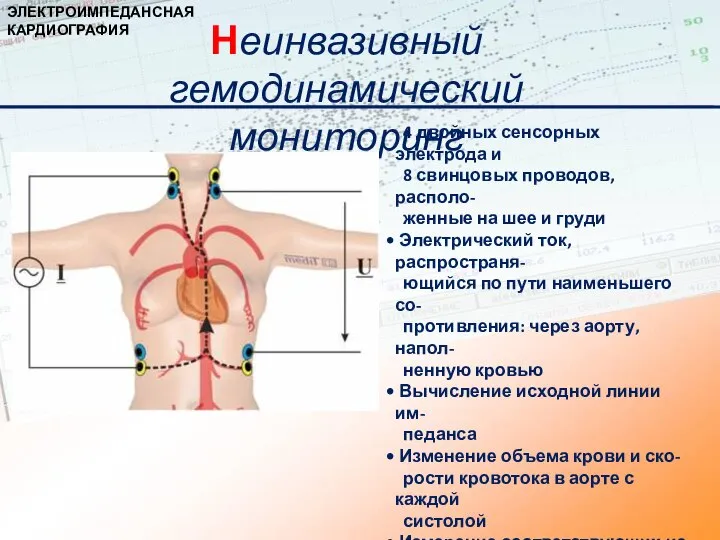 4 двойных сенсорных электрода и 8 свинцовых проводов, располо- женные на