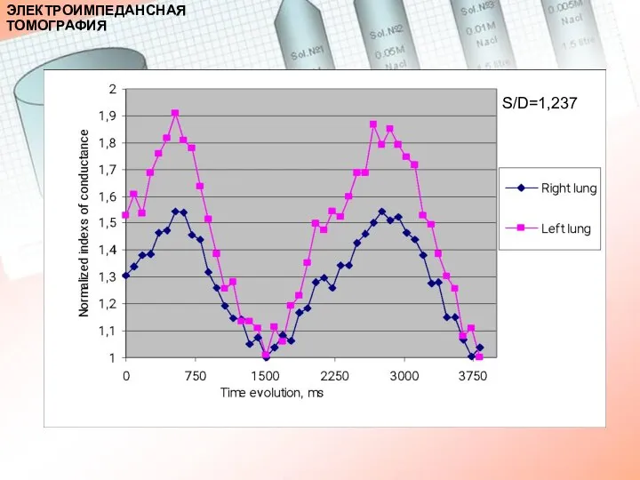 S/D=1,237 ЭЛЕКТРОИМПЕДАНСНАЯ ТОМОГРАФИЯ