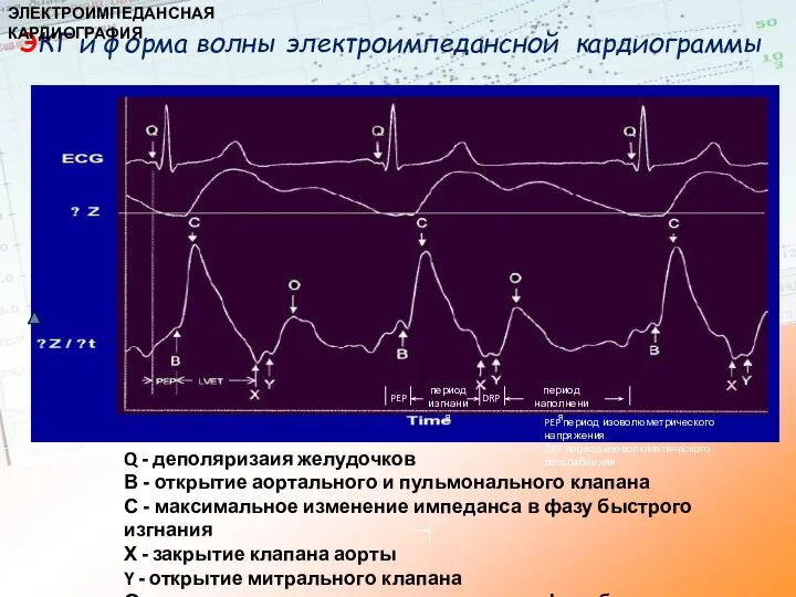 ЭКГ и форма волны электроимпедансной кардиограммы Q - деполяризаия желудочков В