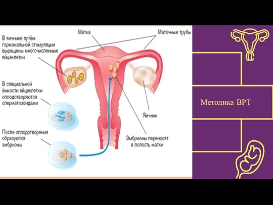 Методика ВРТ