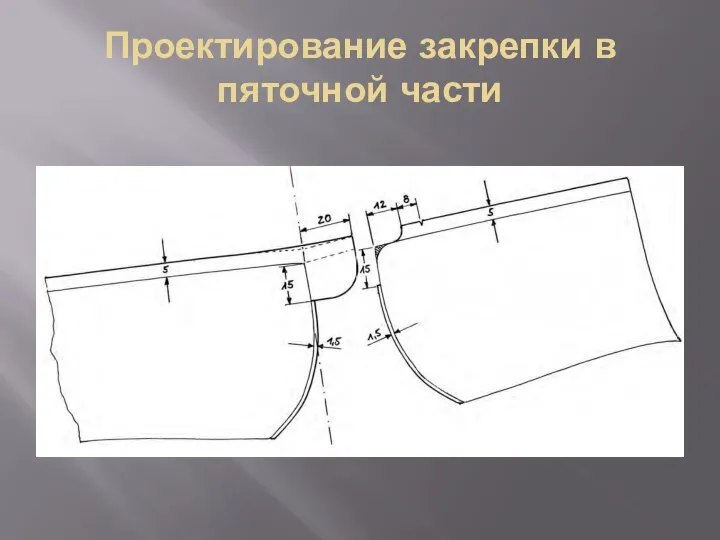 Проектирование закрепки в пяточной части