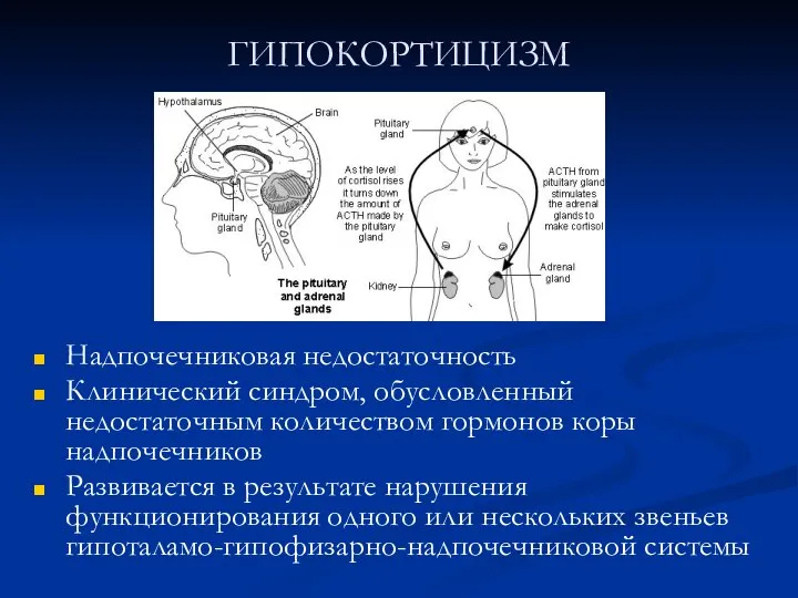 ГИПОКОРТИЦИЗМ Надпочечниковая недостаточность Клинический синдром, обусловленный недостаточным количеством гормонов коры надпочечников