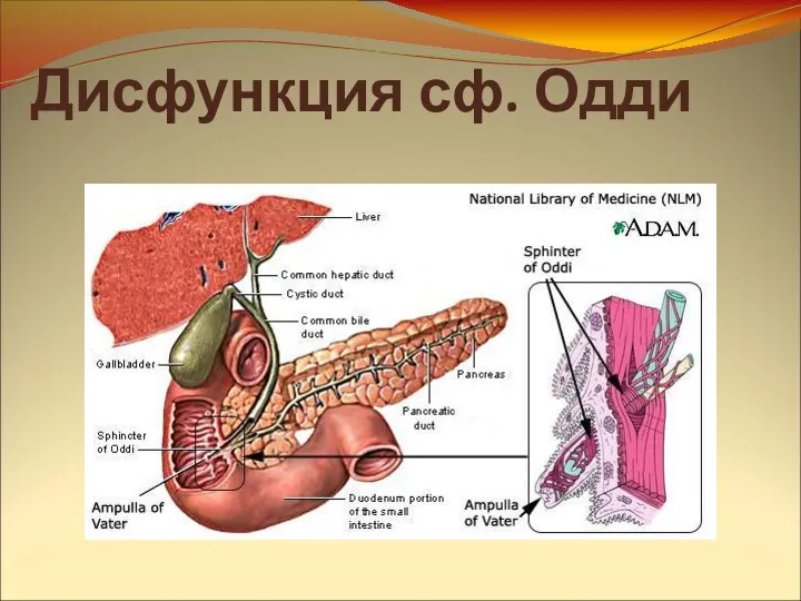 Дисфункция сф. Одди