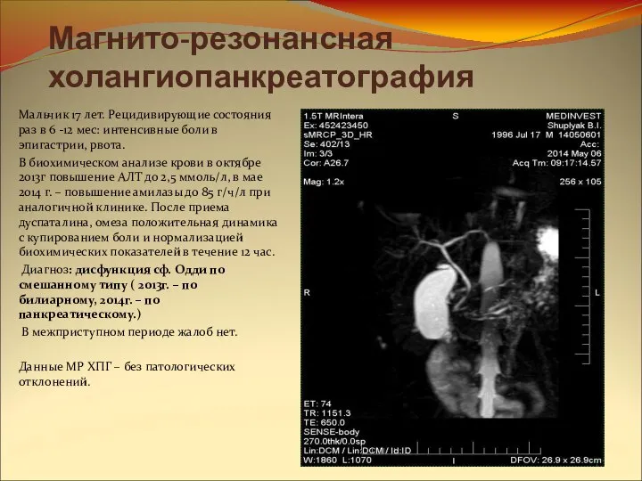Магнито-резонансная холангиопанкреатография Мальчик 17 лет. Рецидивирующие состояния раз в 6 -12
