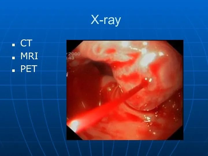 X-ray CT MRI PET