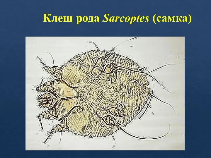 Клещ рода Sarcoptes (самка)