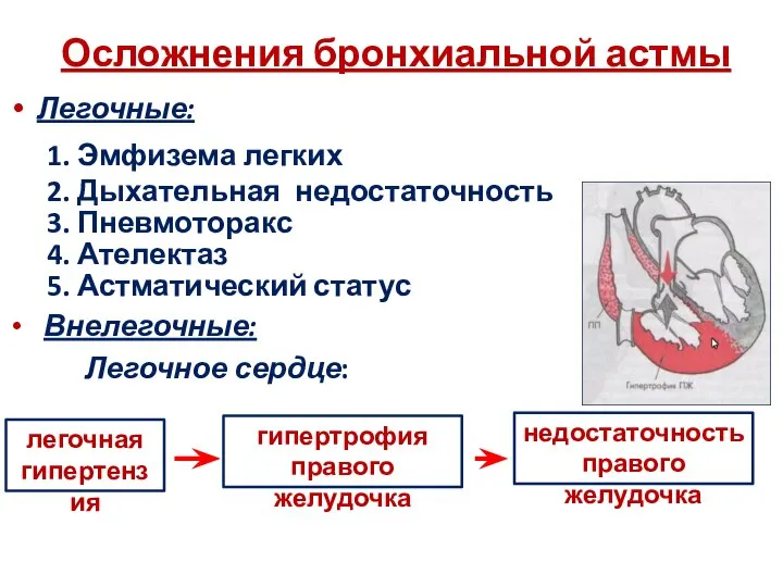 Осложнения бронхиальной астмы Легочные: 1. Эмфизема легких 2. Дыхательная недостаточность 3.