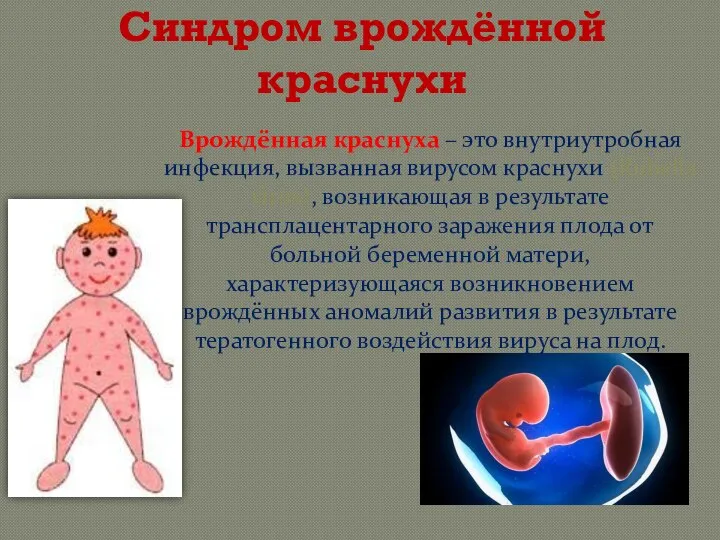 Синдром врождённой краснухи Врождённая краснуха – это внутриутробная инфекция, вызванная вирусом