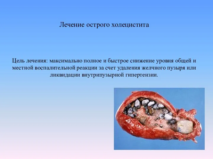 Лечение острого холецистита Цель лечения: максимально полное и быстрое снижение уровня