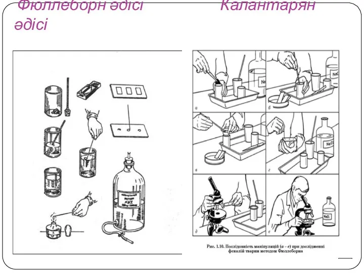 Фюллеборн әдісі Калантарян әдісі