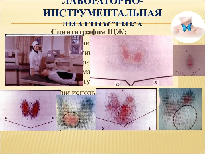 ЛАБОРАТОРНО-ИНСТРУМЕНТАЛЬНАЯ ДИАГНОСТИКА Сцинтиграфия ЩЖ: Позволяет получить информацию о функциональной активности ткани