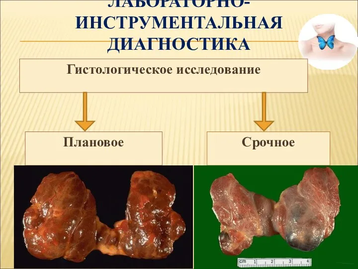 ЛАБОРАТОРНО-ИНСТРУМЕНТАЛЬНАЯ ДИАГНОСТИКА Гистологическое исследование Плановое Срочное