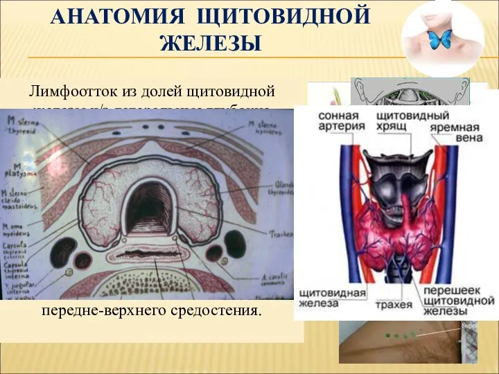 Щитовидная железа, располагающаяся на передней поверхности трахеи, между щитовидным хрящом и