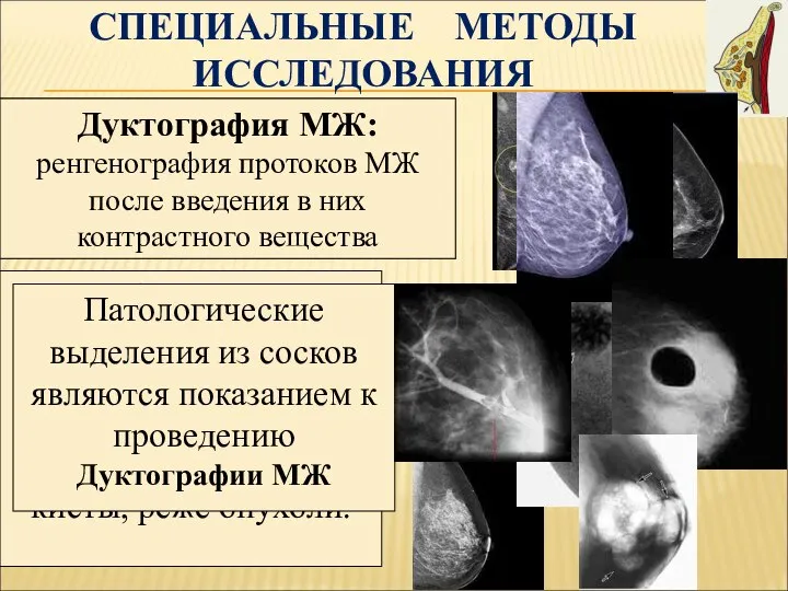 СПЕЦИАЛЬНЫЕ МЕТОДЫ ИССЛЕДОВАНИЯ Маммография: ренгенография МЖ в 2-х проекциях (вертикальной и